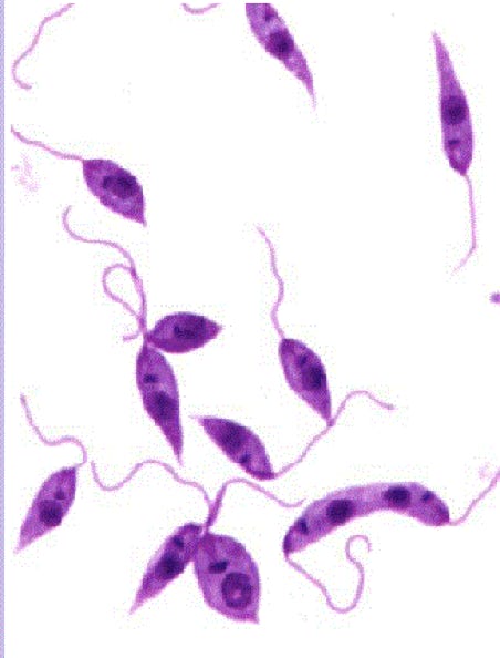 immagine al microscopio delle filarie