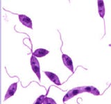 Immagine al microscopio delle leishmanie